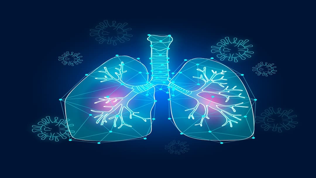 mutations,non-small cell lung cancer